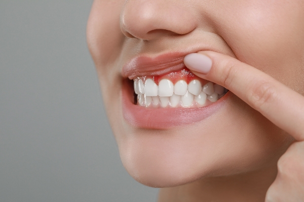 A General Dentist’s Guide To Gum Disease Treatment